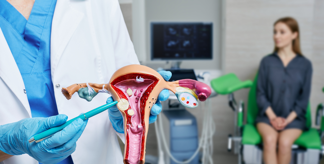 Videohisteroscopia Pode Libertar Você da Dor e do Sofrimento Causados por Pólipos Uterinos