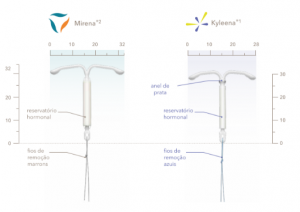 Kyleena®: Sistema Intrauterino De Levonorgestrel - Ceverj Histerolap